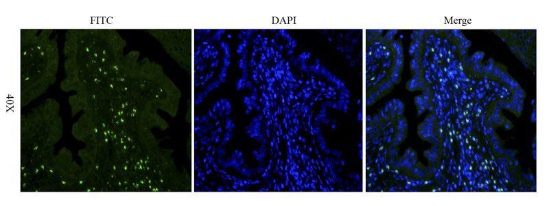 Integrin alpha 5 antibody (FITC)