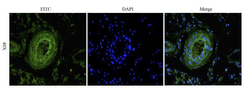 Integrin alpha 5 antibody (FITC)