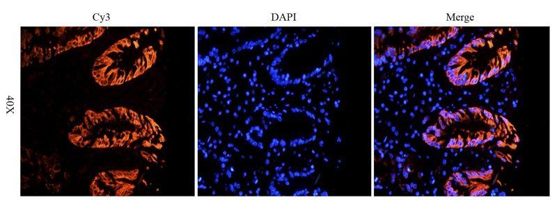 Integrin alpha 5 antibody