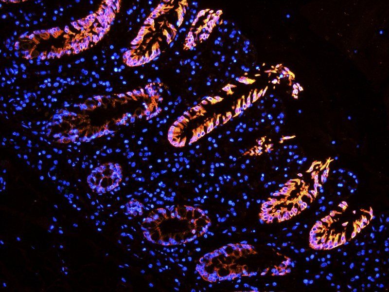 Integrin alpha 5 antibody