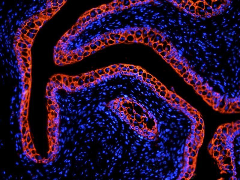 Integrin alpha 5 antibody