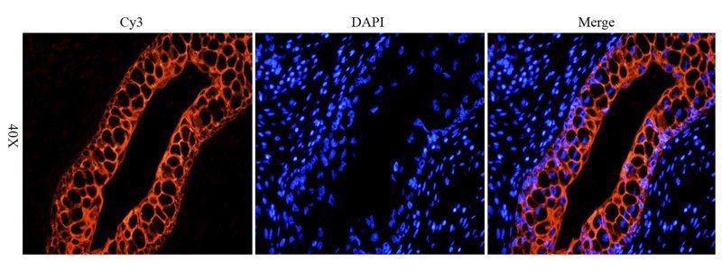 Integrin alpha 5 antibody