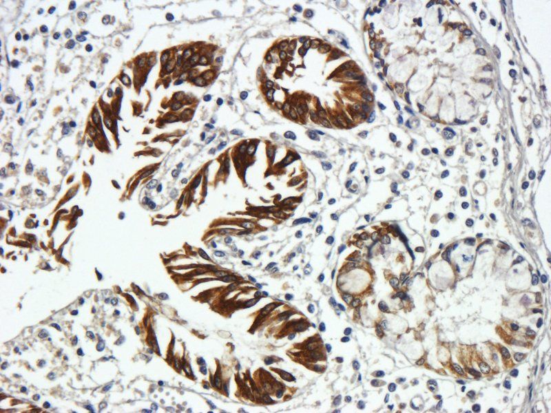 Integrin alpha 5 antibody