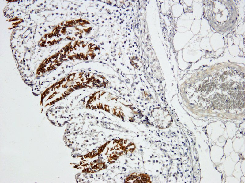 Integrin alpha 5 antibody