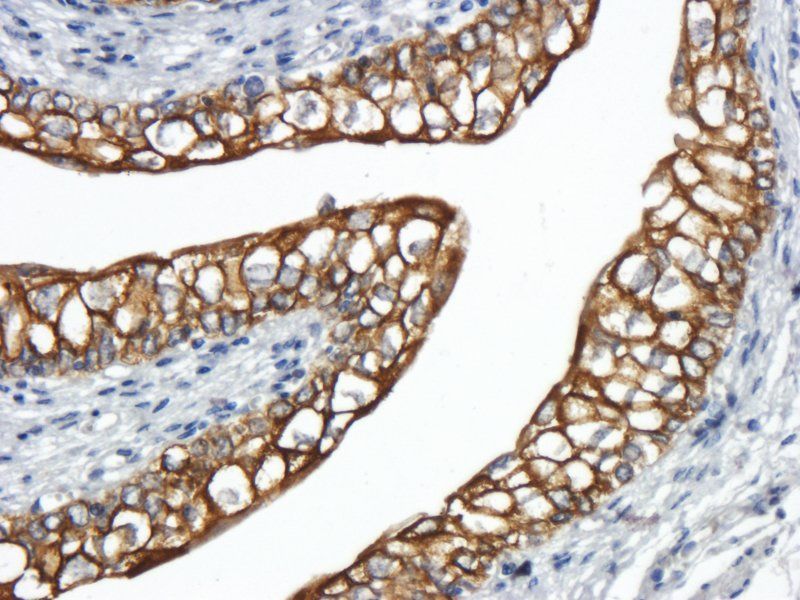 Integrin alpha 5 antibody