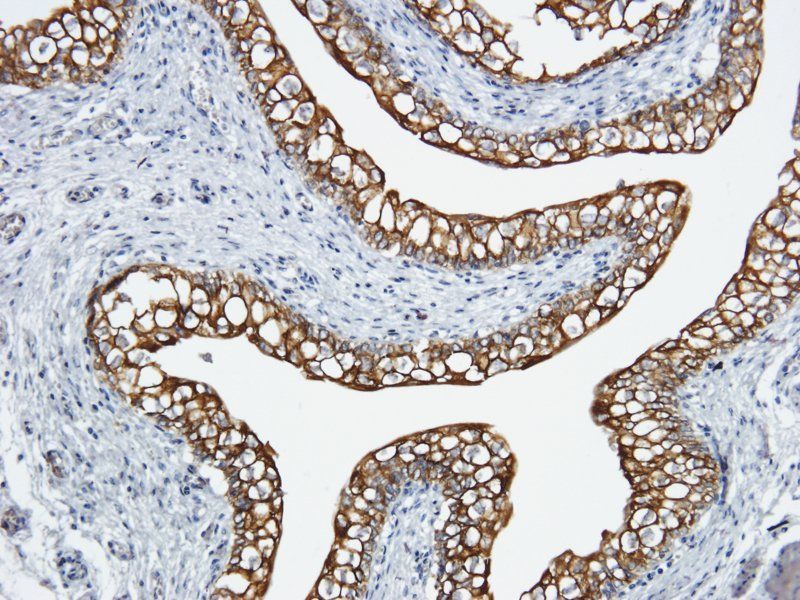 Integrin alpha 5 antibody