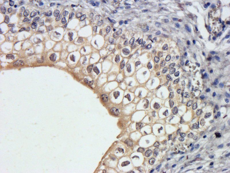 Integrin alpha 5 antibody