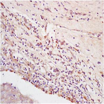 Integrin alpha 5 antibody