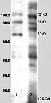 Integrin alpha 5 antibody