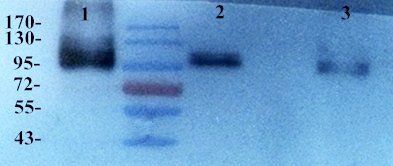 Integrin alpha 5 antibody