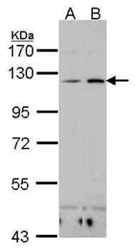 Integrin alphaX Rabbit Polyclonal Antibody