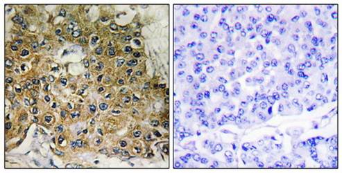 Integrin beta1 (phospho-Thr789) antibody