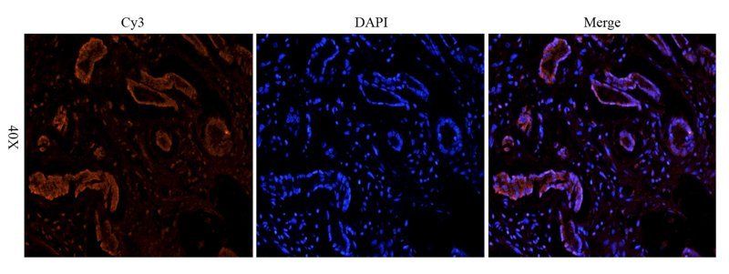 Integrin beta 1 antibody