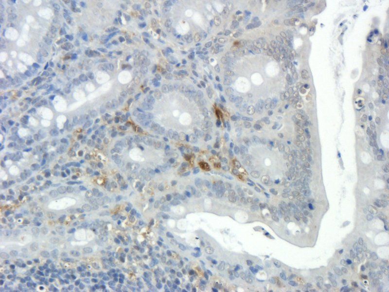 Integrin beta 1 antibody