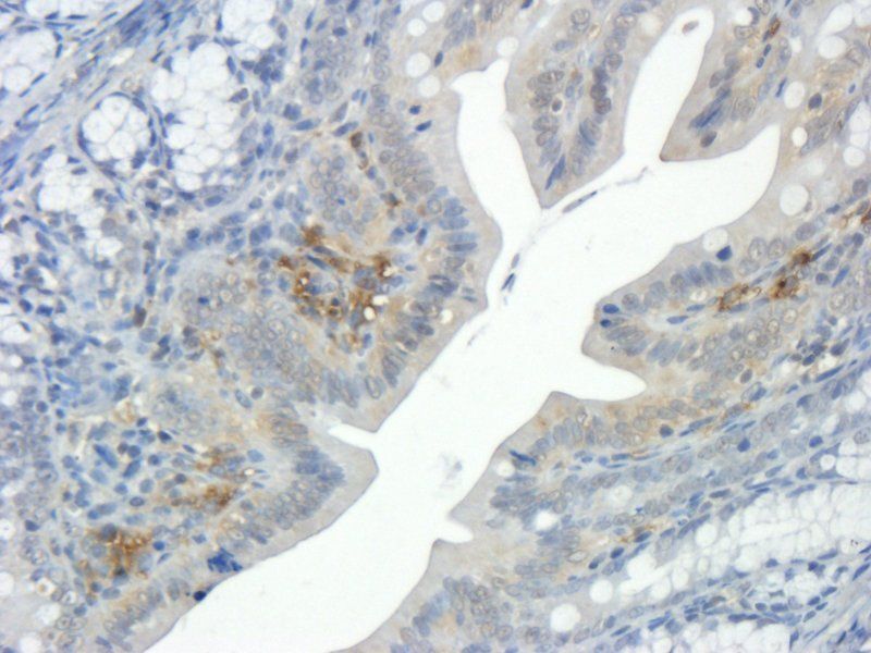 Integrin beta 1 antibody