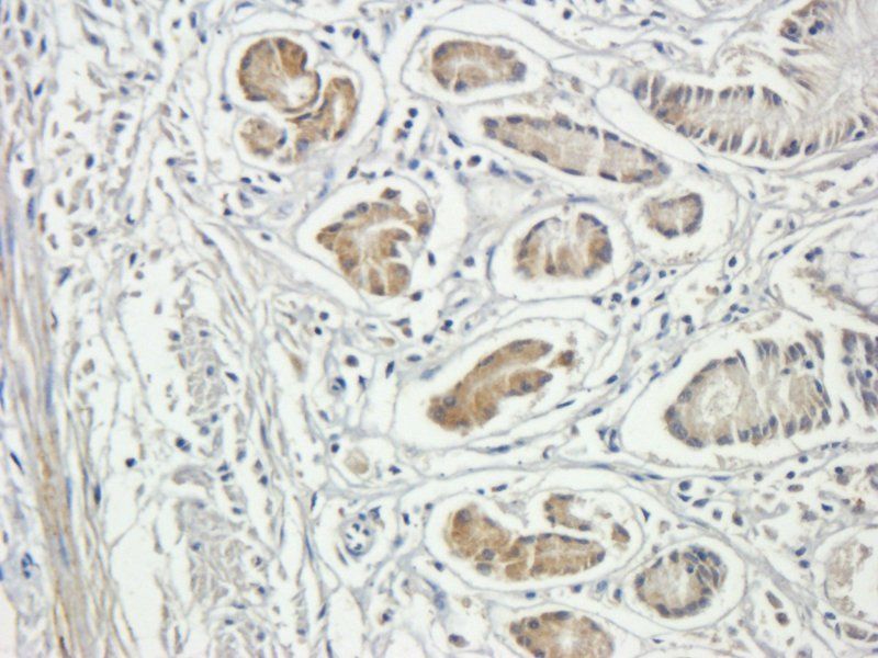 Integrin beta 1 antibody