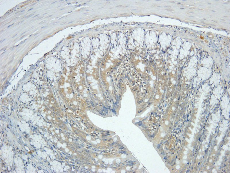 Integrin beta 1 antibody