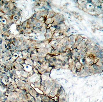 Integrin β3 (Phospho-Tyr773) Antibody