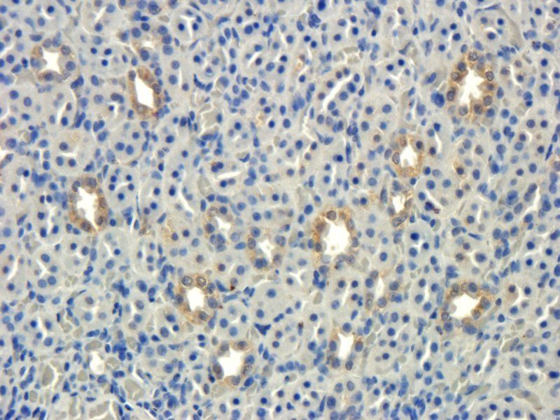 Integrin beta 7 antibody