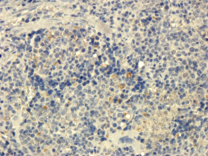 Integrin beta 7 antibody