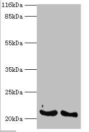Interferon alpha-14 antibody