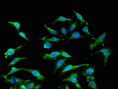 Interferon alpha-2 antibody