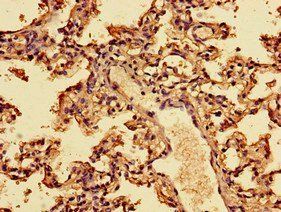IFNA2 Antibody