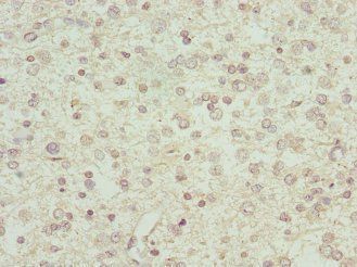 Interferon alpha-2 antibody