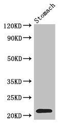 Interferon alpha-2 antibody