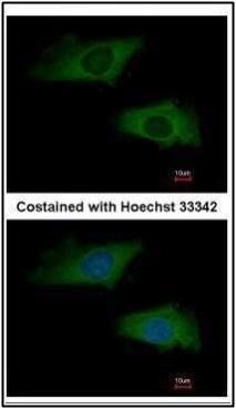 interferon alpha 2 Rabbit Polyclonal Antibody