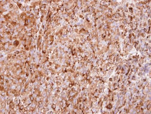 interferon alpha 2 Rabbit Polyclonal Antibody