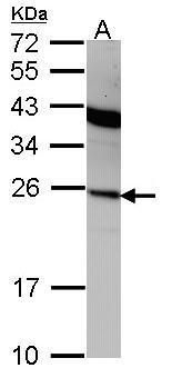 interferon alpha 2 Rabbit Polyclonal Antibody