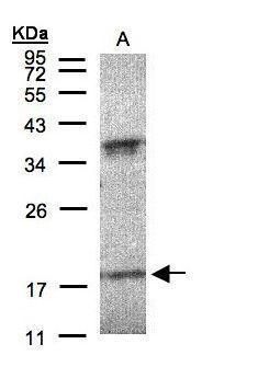 I-309 antibody