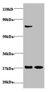 IFNG Antibody