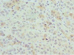 Interferon gamma antibody