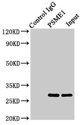 Interferon gamma antibody