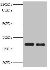 Interferon gamma antibody