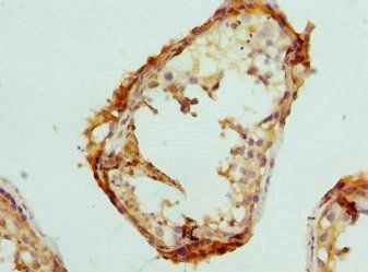 Interferon gamma antibody