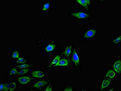 Interferon gamma antibody