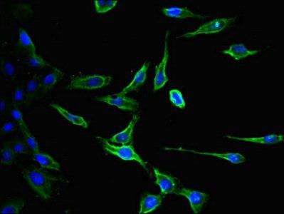 Interferon gamma antibody