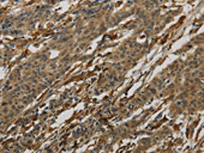 AIF1 Antibody