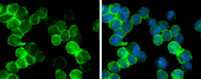 Interferon gamma antibody