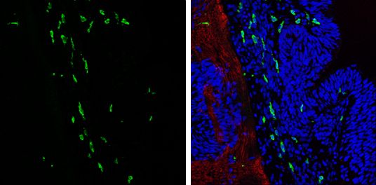 Interferon gamma antibody