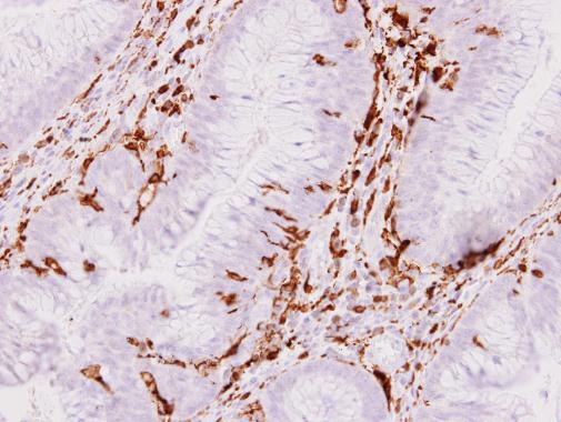 Iba1 antibody