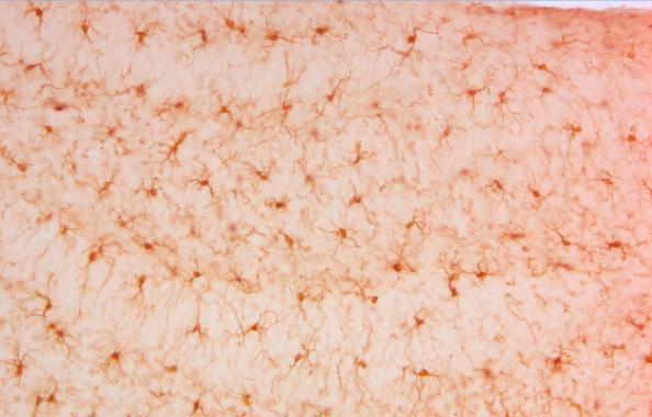 Iba1 antibody