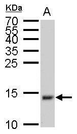 Interferon gamma antibody