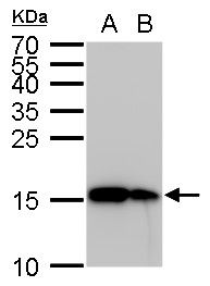 Interferon gamma antibody