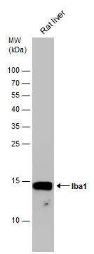 Interferon gamma antibody