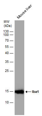 Interferon gamma antibody