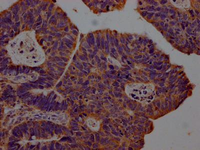 CXCL10 Recombinant Monoclonal Antibody